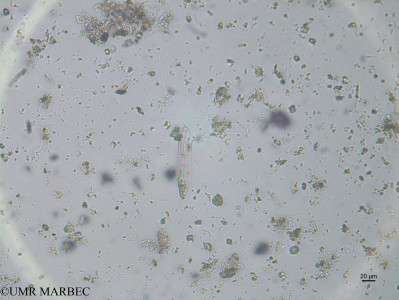 phyto/Brazilian_Nordeste/AtoldasRocas_station52/ABRACOS2 April 2017/Pinnularia sp (ancien Diatoma 11-st24_Found_Diatomee11_Pennée170830_005_ovl)(copy)_thumb.jpg